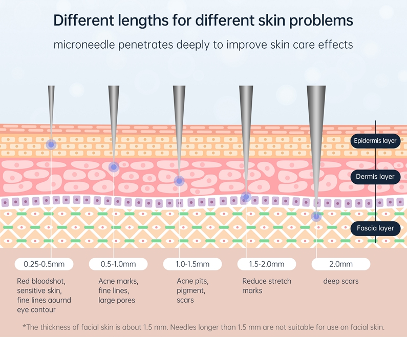 1701406151995481.jpg BIO Needle 120-8.jpg